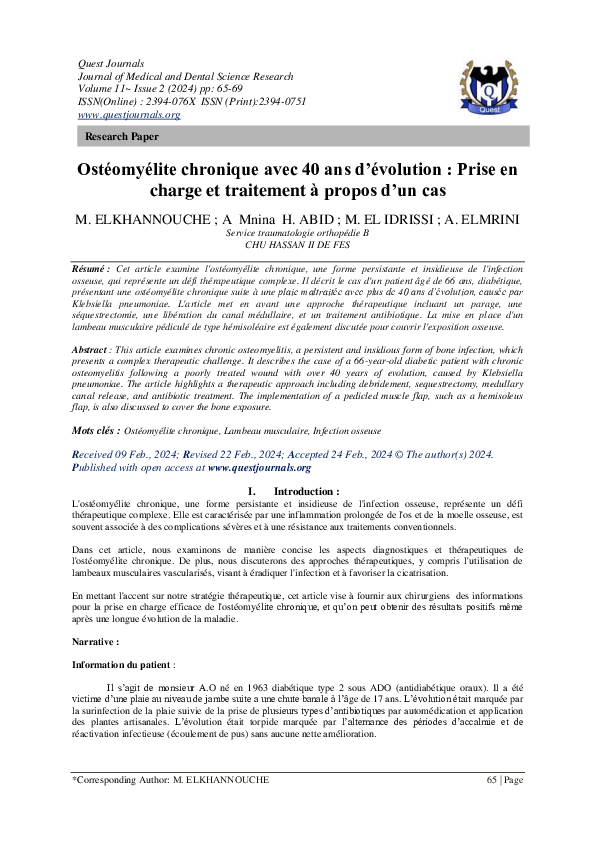 découvrez l'évolution du célèbre opel combo à travers 40 ans d'innovation, de design et de performance.